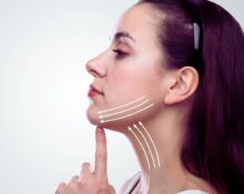 Post-Neck Lift Care: Tips for a Smooth Recovery